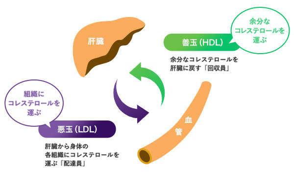 脂質異常症とコレステロールの画像